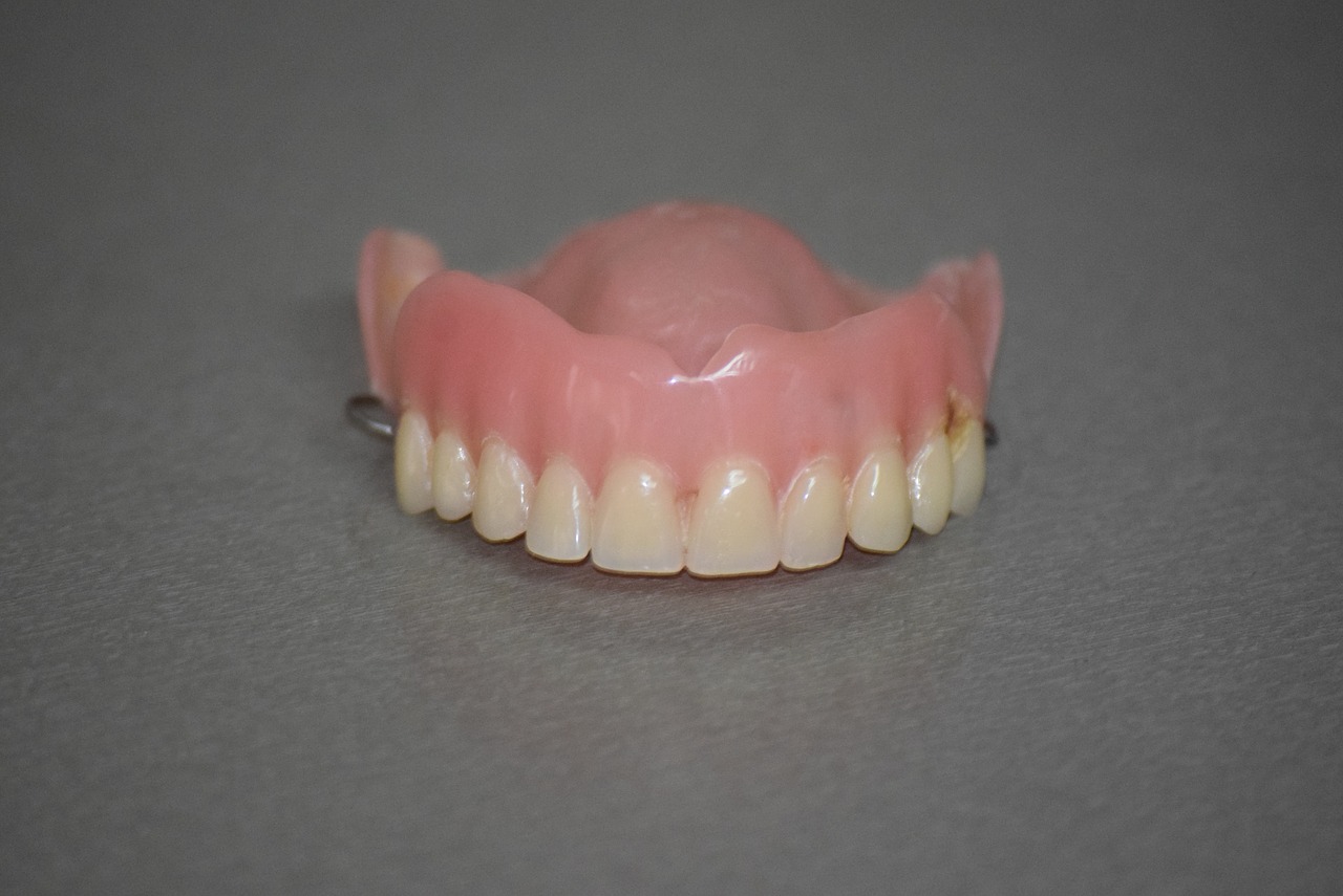 protesi dentale mobile - dentiera